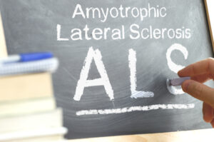 Als 2