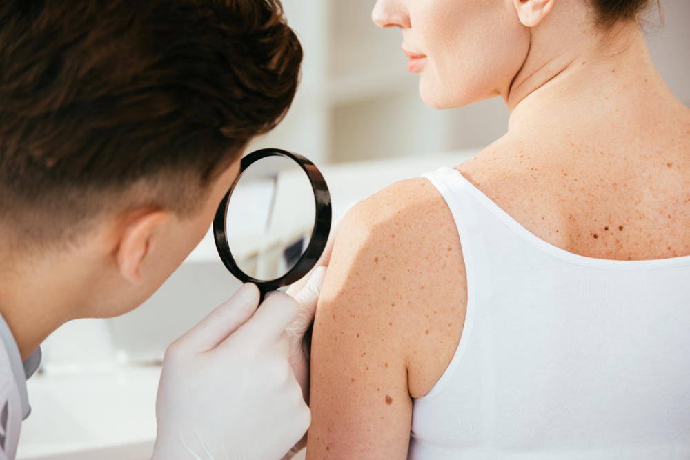 Skin cancer