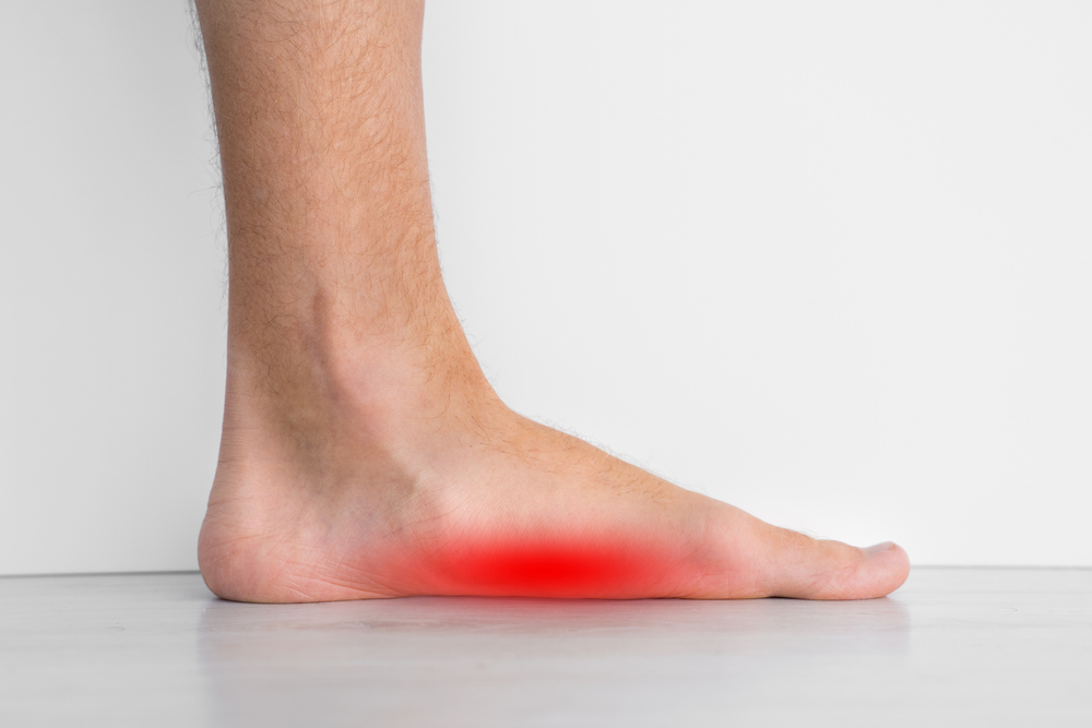 Flat feet