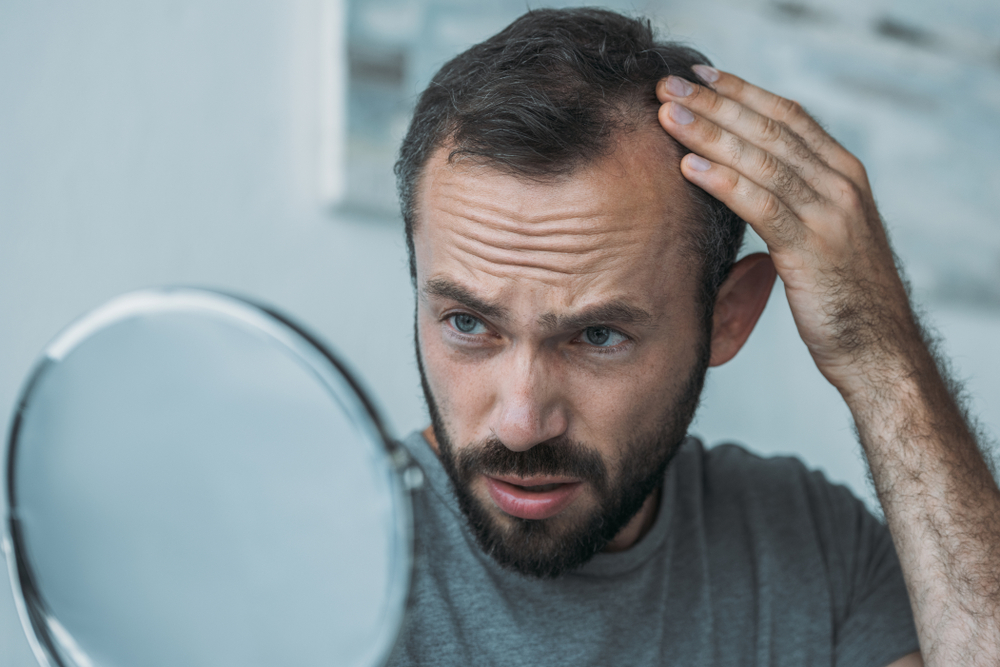 Prevent hair loss: 7 common causes and what to do 1 Hair loss