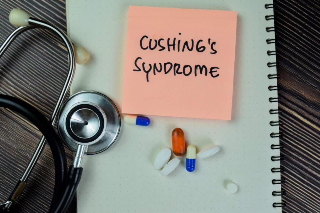 Cushing’s syndrome : all you need to know 1 Cushing’s syndrome