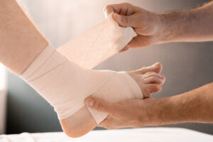 Sprain