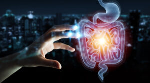 Ulcerative colitis 1 Ulcerative colitis
