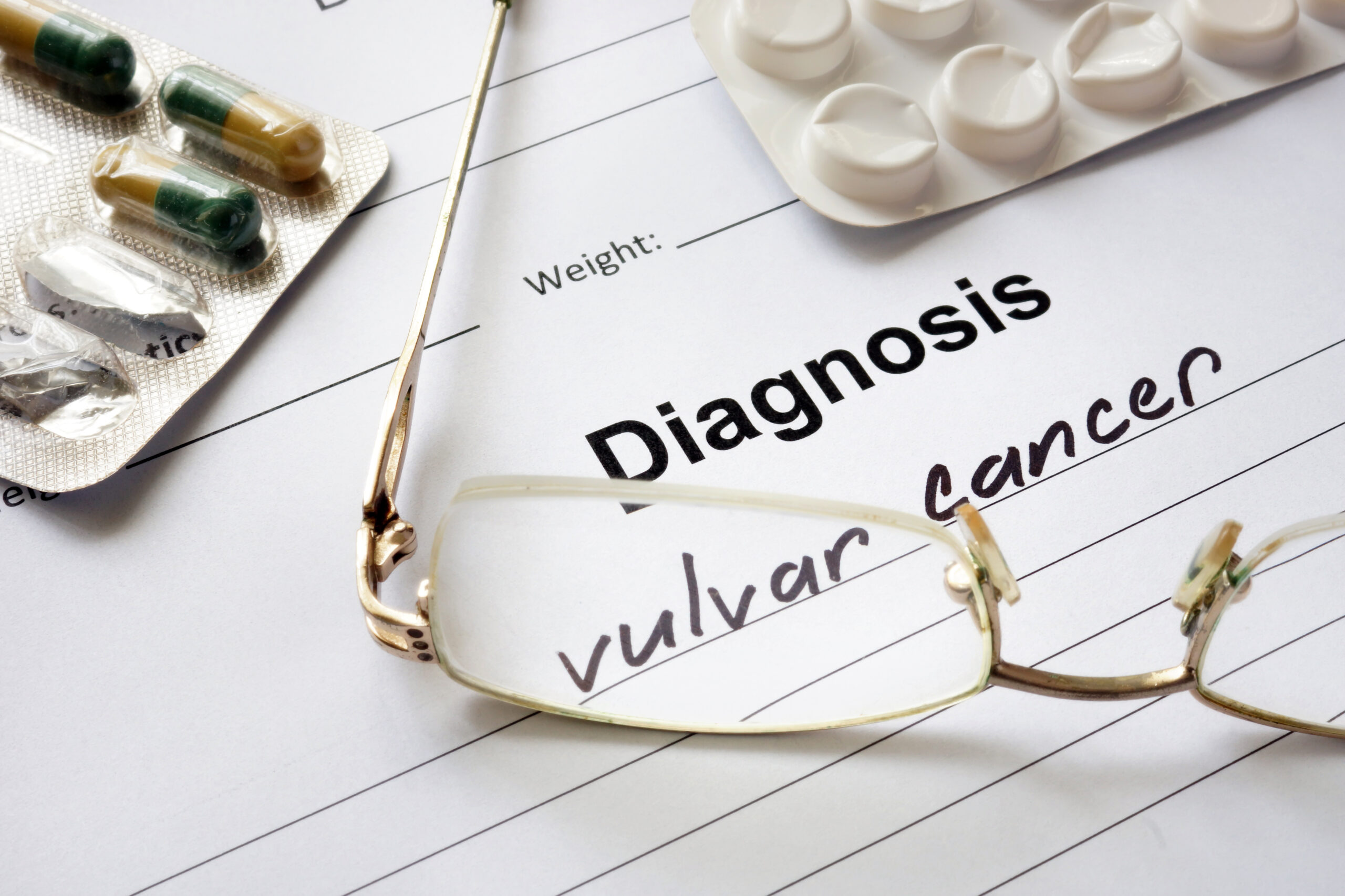 Vulvar Cancer