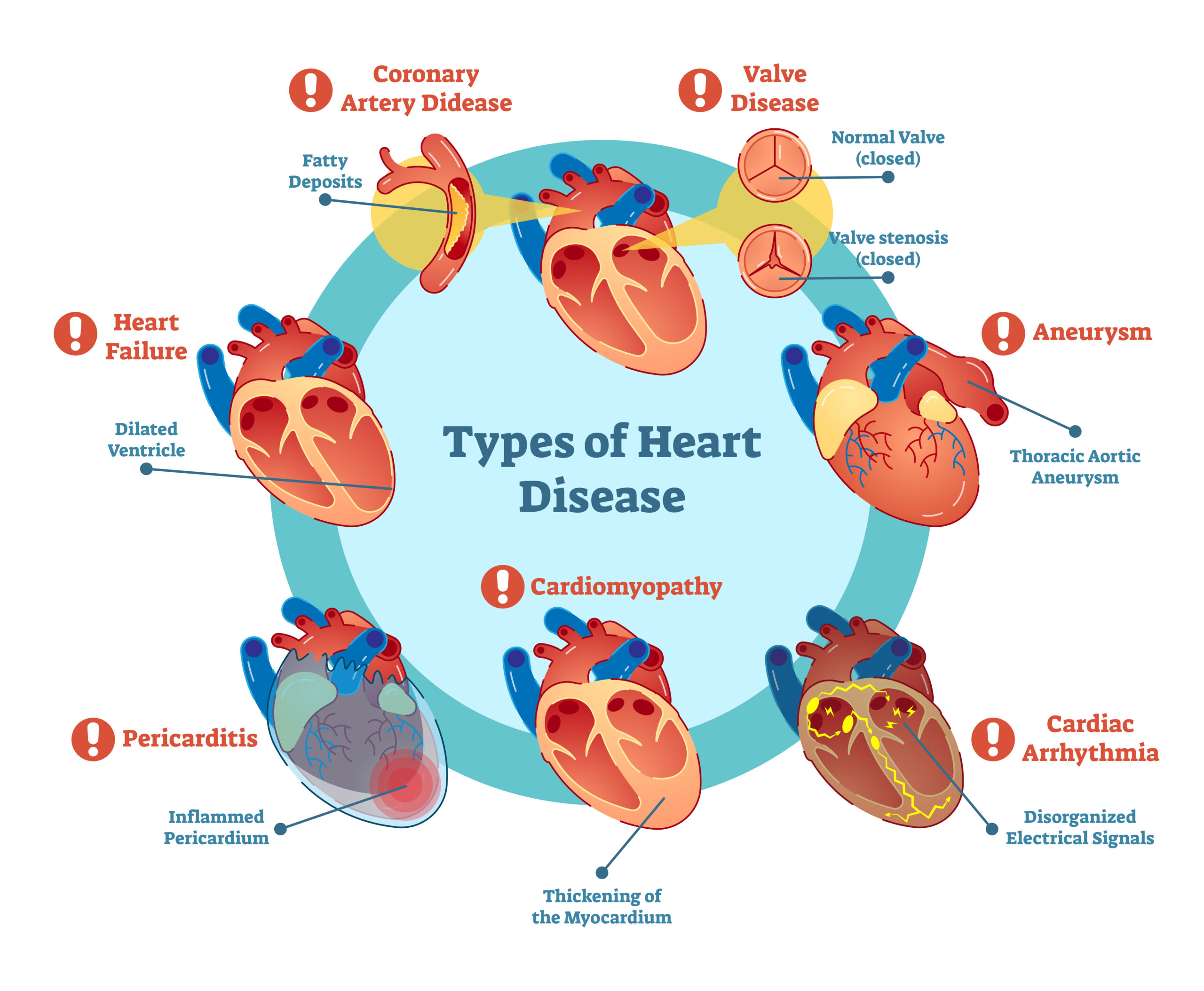 types of heart disease