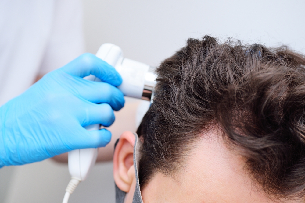 Scalp Conditions