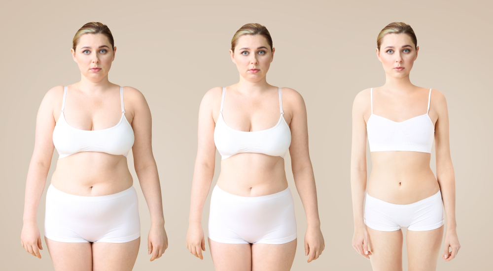 Stages of weight loss journey