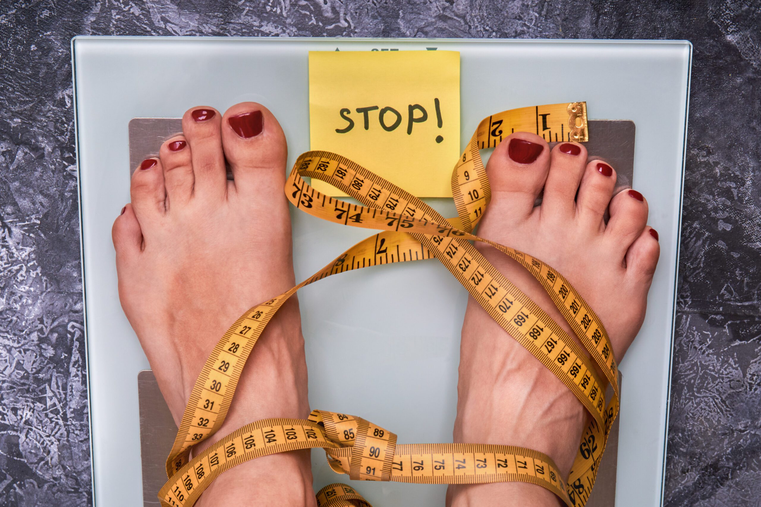 Coping with obesity