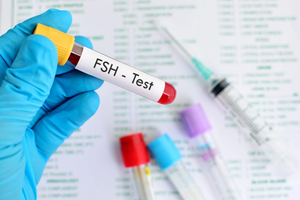 Fsh test