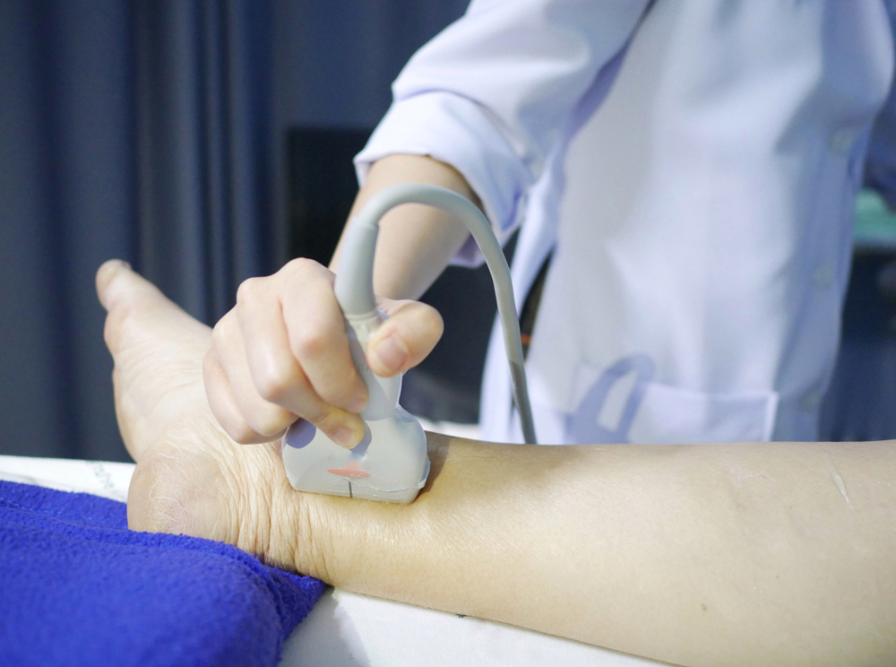deep vein thrombosis diagnosis