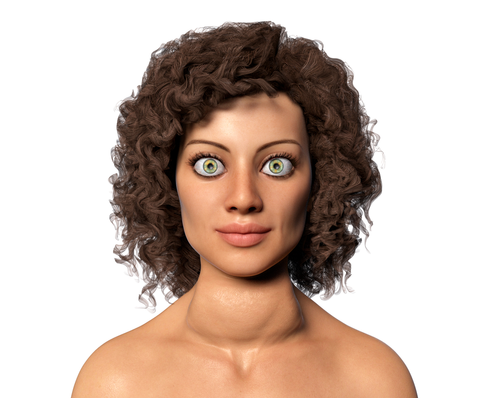 thyroid eye disease