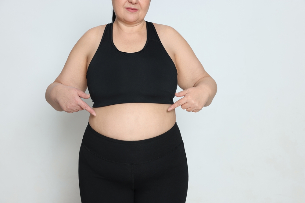 Bariatric surgery