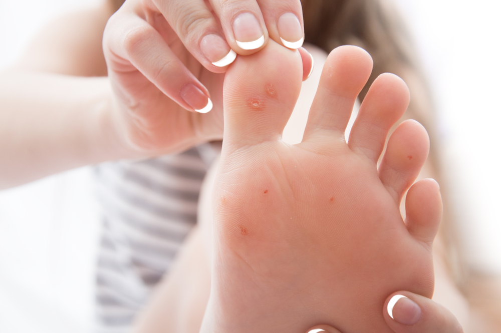 Callus