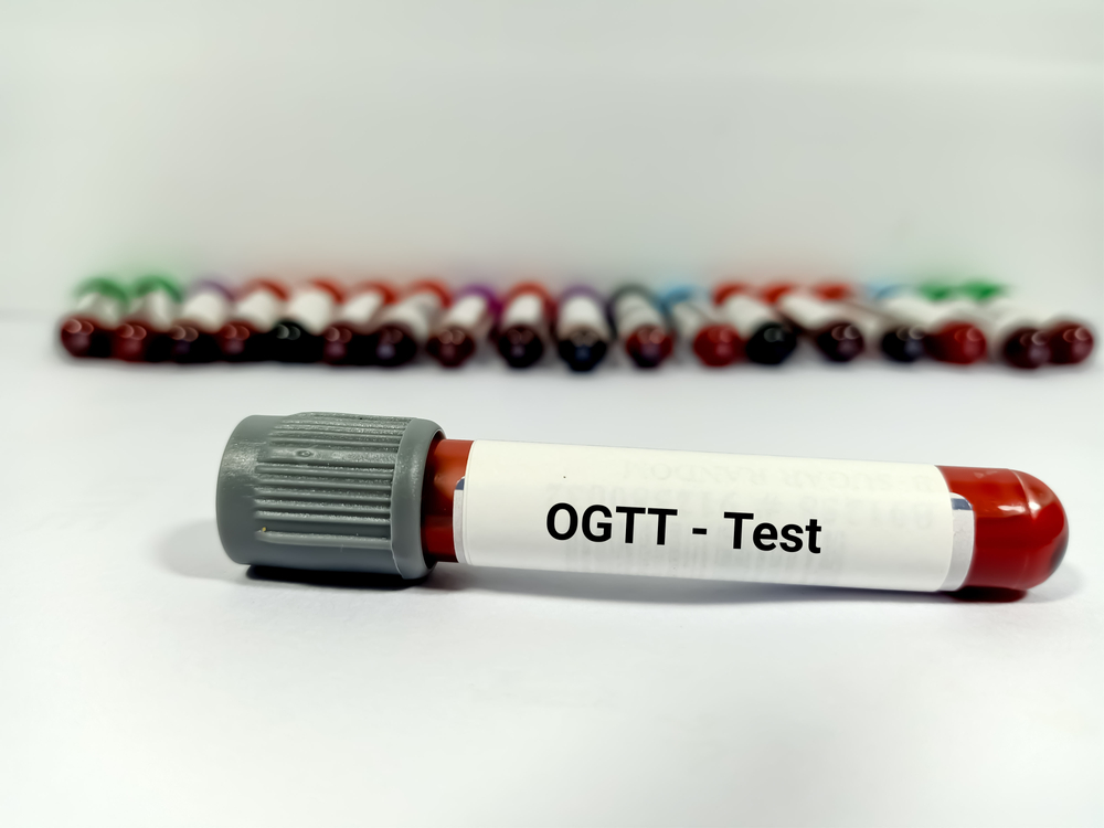 Oral glucose tolerance test: step-by-step guide for first-time patients 1 Oral glucose tolerance test