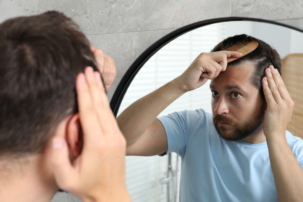 Symptoms of Alopecia