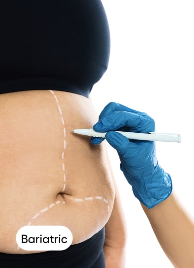 Bariatric