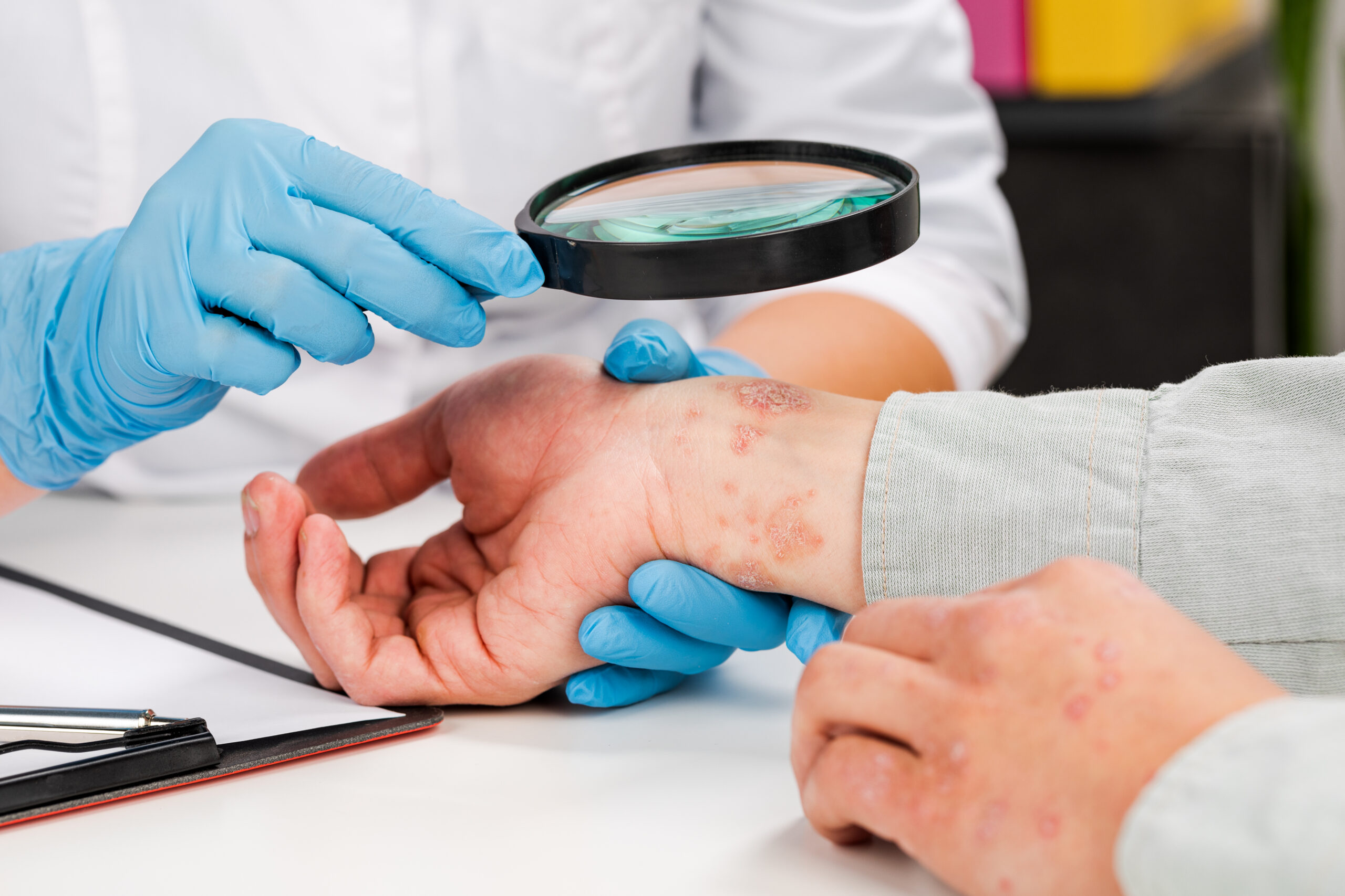 Skin Allergies