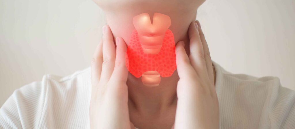 Thyroidectomy