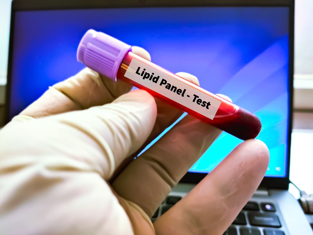 Lipid panel 