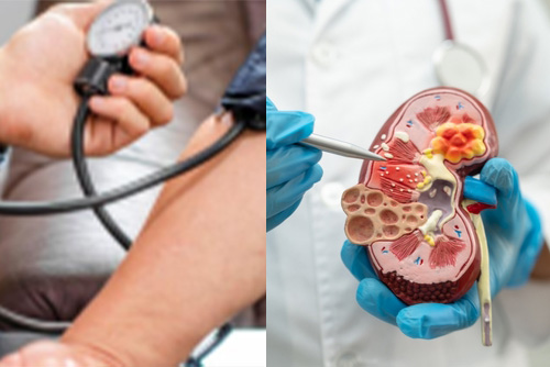 CKD blood pressure target