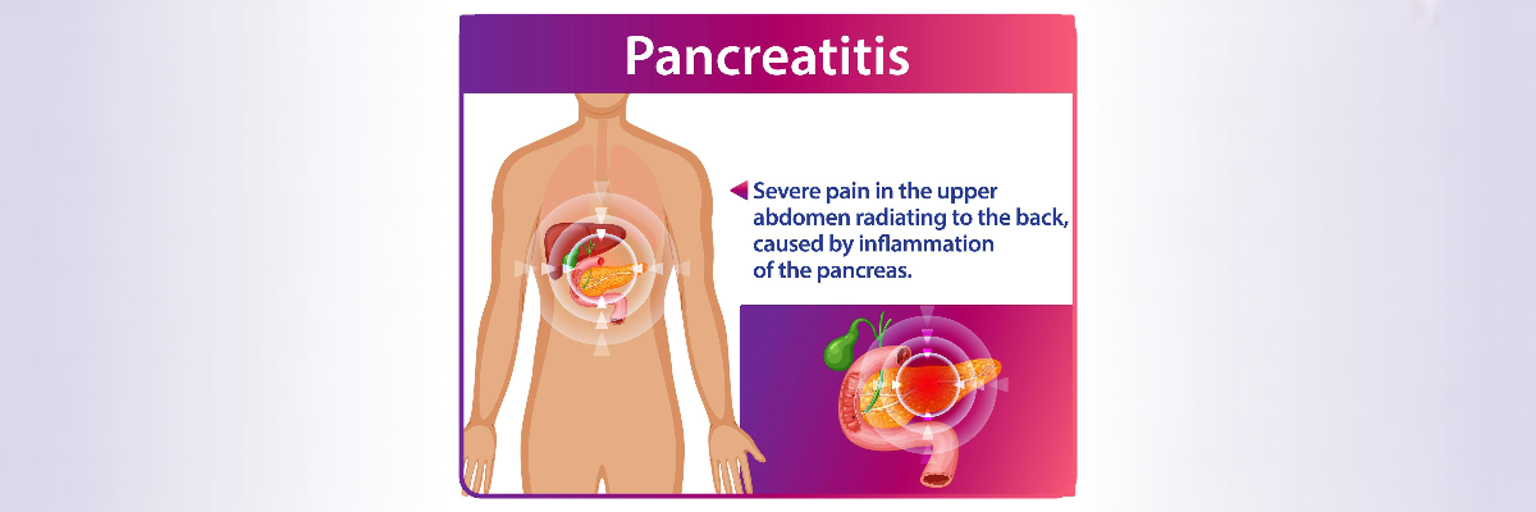Pancreatitis symptoms showing abdominal pain near the pancreas and digestive system inflammation