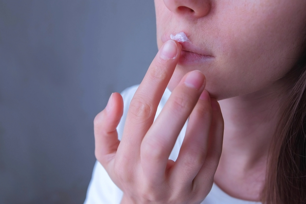 7 powerful herpes home remedies for fast relief 1 Simple, effective herpes home remedies that help reduce discomfort, calm irritation, and support healing during outbreaks.
