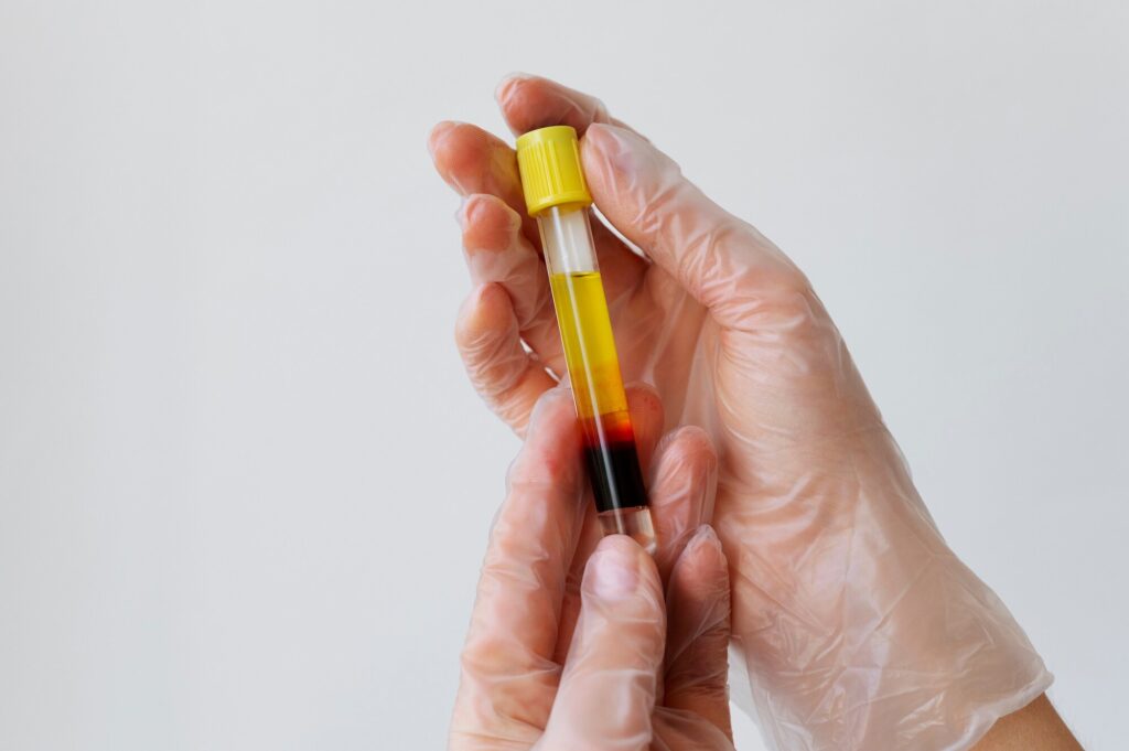 Plasmapheresis