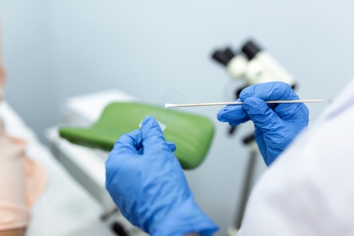 Pap smear results
