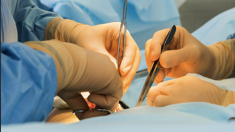 What is revision surgery