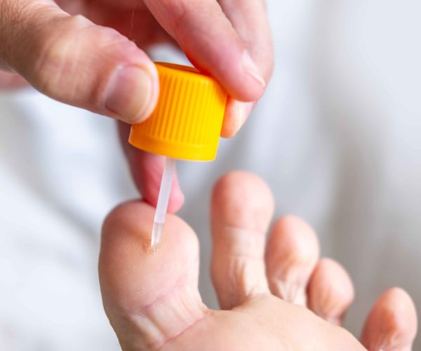 Foot Lesion Removal