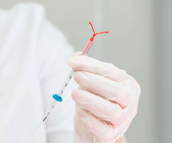 IUD-Insertion-and-Removal