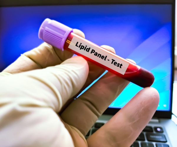 Lipid Panel 
