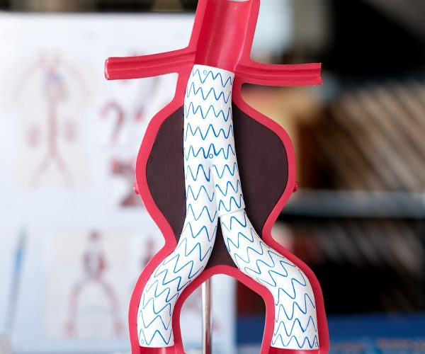 Endovascular Aneurysm Repair (EVAR)