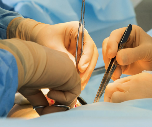 what-is-revision-surgery
